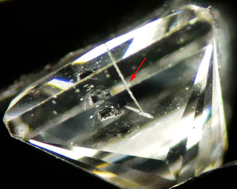 اینکلوژن ناشی از سوراخ کاری لیزری الماس